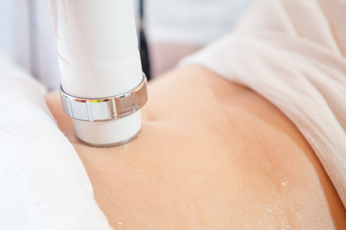 Can Laser Lipo Cause Cancer?
